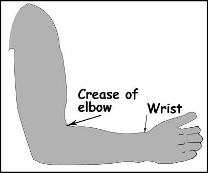 Donjoy IROM Elbow Brace sizing